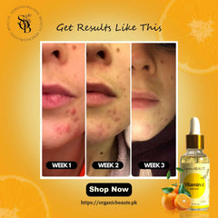Vitamin C Serum - 30ml