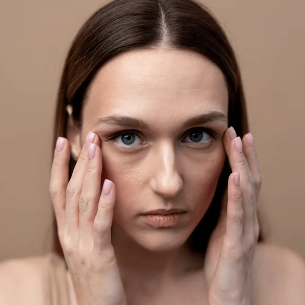 Dark Circles and Puffiness