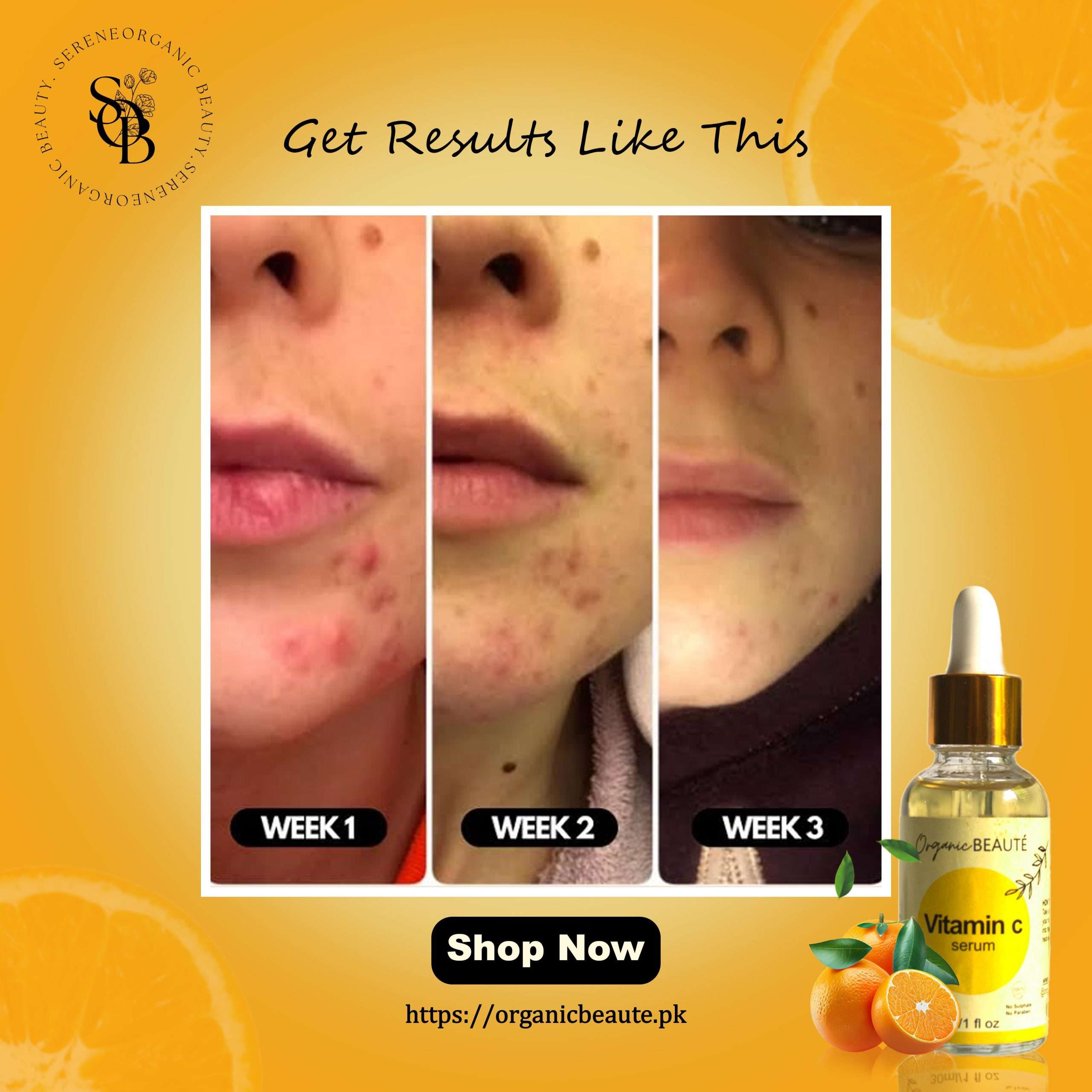 Vitamin C Serum - 30ml